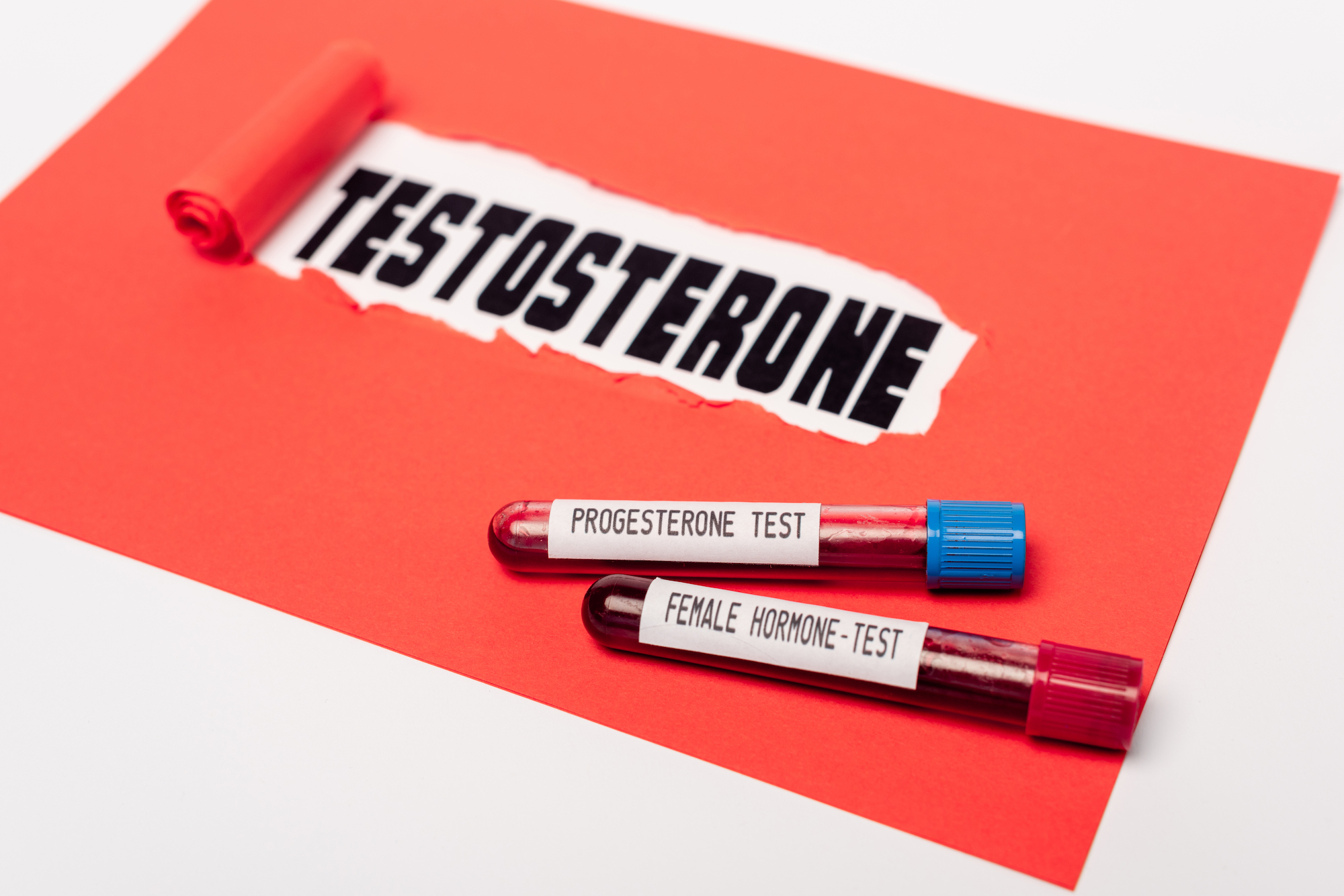 testosterone-progesteronehormone sign