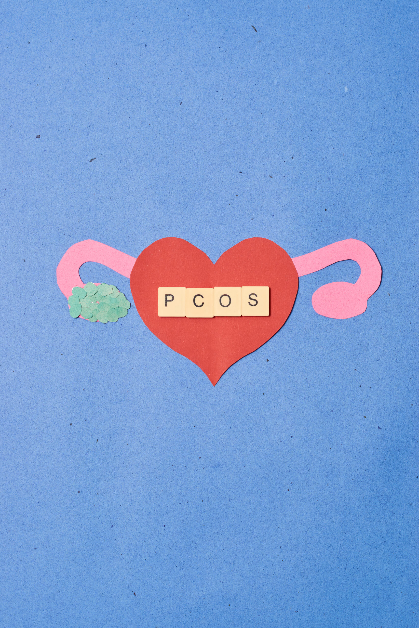 Concept polycystic ovary syndrome, PCOS. Women reproductive system